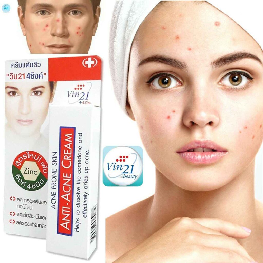 vin21-anti-acne-cream-my-blog